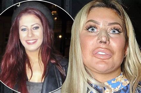 chloe ferry then and now|chloe ferry before and after.